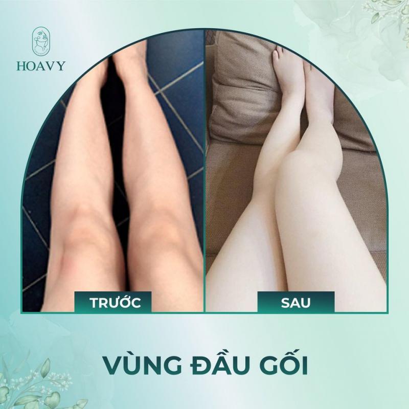 Thẩm mỹ viện Hoa Vy