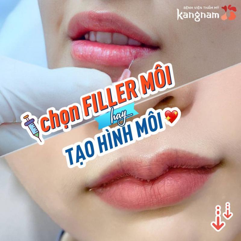 Bệnh viện thẩm mỹ Kangnam