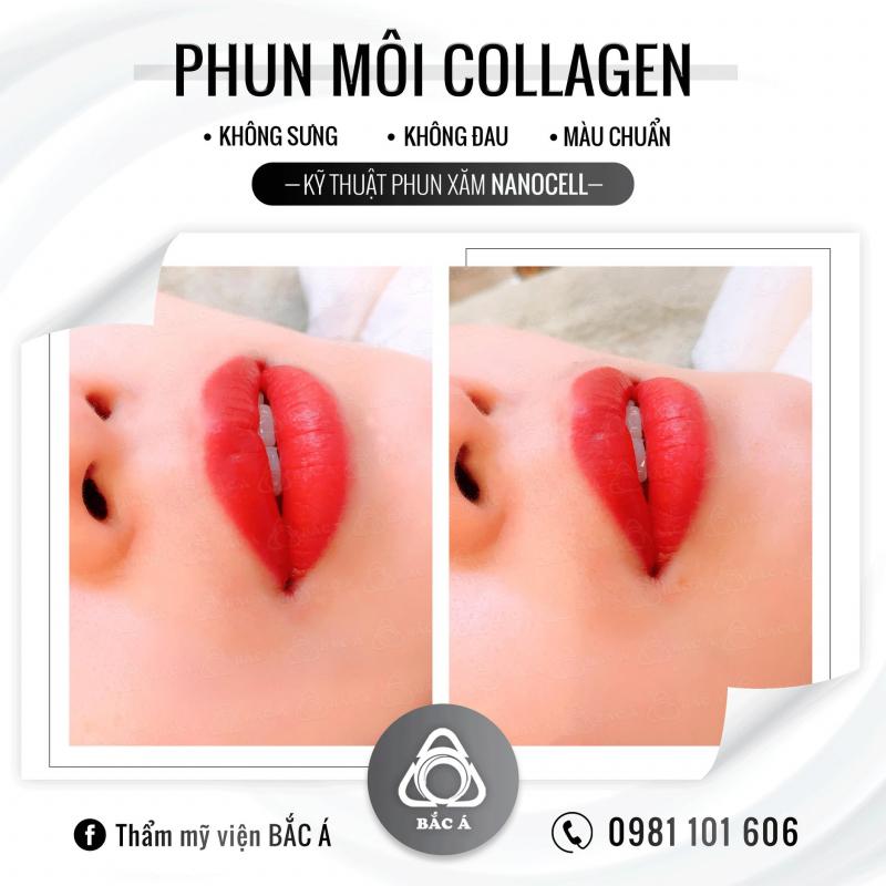 Thẩm mỹ viện Bắc Á