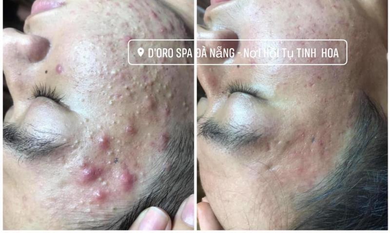 D'ORO Spa Đà Nẵng